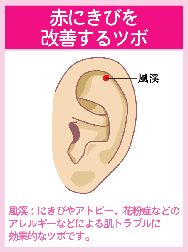 ニキビを改善する耳ツボ