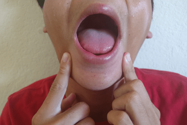 顎のストレッチ方法：ア　と言う口の形で大きくあける