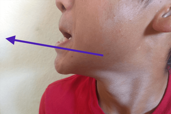 顎のストレッチ方法：顎を前に出してアイーン